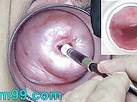 Japanese Endoscope Camera inside Cervix Cam into Vagina